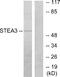 STEAP3 Metalloreductase antibody, A30509, Boster Biological Technology, Western Blot image 