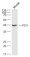Purinergic Receptor P2Y12 antibody, orb11205, Biorbyt, Western Blot image 
