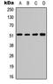 Activating Transcription Factor 2 antibody, LS-C358917, Lifespan Biosciences, Western Blot image 