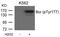 BCR Activator Of RhoGEF And GTPase antibody, GTX50242, GeneTex, Western Blot image 