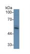 Activin A Receptor Type 2A antibody, LS-C292628, Lifespan Biosciences, Western Blot image 