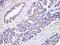 MutS Homolog 6 antibody, LS-C744537, Lifespan Biosciences, Immunohistochemistry frozen image 