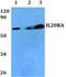 Interleukin 20 Receptor Subunit Alpha antibody, PA5-75777, Invitrogen Antibodies, Western Blot image 