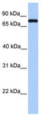 Complement C2 antibody, TA346155, Origene, Western Blot image 