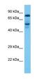 Rhophilin Rho GTPase Binding Protein 2 antibody, orb326379, Biorbyt, Western Blot image 