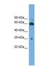 GLIPR1 Like 1 antibody, NBP1-57060, Novus Biologicals, Western Blot image 