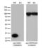 NME/NM23 Nucleoside Diphosphate Kinase 1 antibody, LS-C796841, Lifespan Biosciences, Western Blot image 