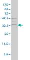 TPS1 antibody, H00007177-M01, Novus Biologicals, Western Blot image 