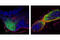 Cellular Retinoic Acid Binding Protein 1 antibody, 13163S, Cell Signaling Technology, Immunofluorescence image 