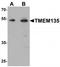 Transmembrane Protein 135 antibody, TA320005, Origene, Western Blot image 