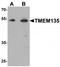 Transmembrane Protein 135 antibody, TA320005, Origene, Western Blot image 