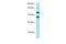 Sideroflexin 2 antibody, A14369, Boster Biological Technology, Western Blot image 