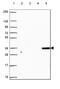 Sulfotransferase Family 2A Member 1 antibody, HPA063633, Atlas Antibodies, Western Blot image 