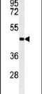 Transmembrane Protein 30B antibody, PA5-24890, Invitrogen Antibodies, Western Blot image 