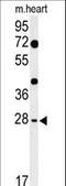 Hes Family BHLH Transcription Factor 7 antibody, LS-C166843, Lifespan Biosciences, Western Blot image 