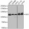 LIG3 antibody, A1887, ABclonal Technology, Western Blot image 