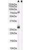 Estrogen Receptor Binding Site Associated Antigen 9 antibody, orb19280, Biorbyt, Western Blot image 