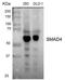 SMAD Family Member 4 antibody, LS-C334197, Lifespan Biosciences, Western Blot image 