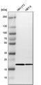 Translocase Of Outer Mitochondrial Membrane 22 antibody, PA5-51804, Invitrogen Antibodies, Western Blot image 