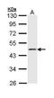 Keratin 18 antibody, GTX112978, GeneTex, Western Blot image 