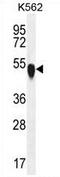 Tubulin Alpha 1c antibody, AP54414PU-N, Origene, Western Blot image 