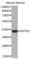 Somatostatin Receptor 2 antibody, abx002252, Abbexa, Western Blot image 