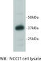 RRAD And GEM Like GTPase 2 antibody, MBS355129, MyBioSource, Western Blot image 