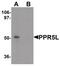 Proline Rich 5 Like antibody, PA5-21129, Invitrogen Antibodies, Western Blot image 