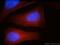 Myosin Heavy Chain 10 antibody, 21403-1-AP, Proteintech Group, Immunofluorescence image 