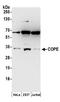 Coatomer Protein Complex Subunit Epsilon antibody, A304-518A, Bethyl Labs, Western Blot image 