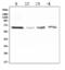 Polo Like Kinase 1 antibody, M00182, Boster Biological Technology, Western Blot image 