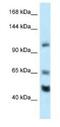 RE1 Silencing Transcription Factor antibody, NBP1-82399, Novus Biologicals, Western Blot image 