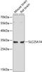 Solute Carrier Family 25 Member 14 antibody, GTX66201, GeneTex, Western Blot image 