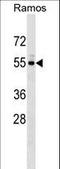 Unc-5 Family C-Terminal Like antibody, LS-C157327, Lifespan Biosciences, Western Blot image 