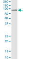 Histidine Ammonia-Lyase antibody, LS-C197395, Lifespan Biosciences, Immunoprecipitation image 