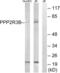 Protein Phosphatase 2 Regulatory Subunit B'Delta antibody, abx014866, Abbexa, Western Blot image 