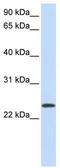 ADP Ribosylation Factor 1 antibody, TA346559, Origene, Western Blot image 