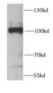 Cell Cycle And Apoptosis Regulator 2 antibody, FNab01338, FineTest, Western Blot image 