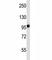 Integrin Subunit Beta 7 antibody, F44498-0.4ML, NSJ Bioreagents, Western Blot image 