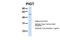 Phosphatidylinositol Glycan Anchor Biosynthesis Class T antibody, 26-193, ProSci, Western Blot image 