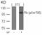 RB Transcriptional Corepressor 1 antibody, GTX50193, GeneTex, Western Blot image 