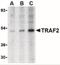 TNF receptor-associated factor 2 antibody, NBP1-77248, Novus Biologicals, Western Blot image 