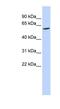 Reticulophagy Regulator Family Member 3 antibody, NBP1-60104, Novus Biologicals, Western Blot image 