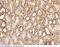 Hypoxia Inducible Factor 1 Subunit Alpha Inhibitor antibody, 101652-T10, Sino Biological, Immunohistochemistry frozen image 