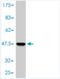 Ubiquitin Conjugating Enzyme E2 A antibody, H00007319-M01, Novus Biologicals, Western Blot image 