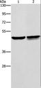 Alpha-Methylacyl-CoA Racemase antibody, LS-C400545, Lifespan Biosciences, Western Blot image 