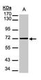 Mesothelin antibody, PA5-21662, Invitrogen Antibodies, Western Blot image 