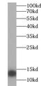 Vesicle Associated Membrane Protein 1 antibody, FNab09358, FineTest, Western Blot image 