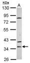 Zona Pellucida Glycoprotein 1 antibody, NBP2-21052, Novus Biologicals, Western Blot image 