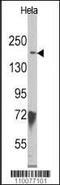 Lysine Demethylase 6B antibody, MBS9214194, MyBioSource, Western Blot image 